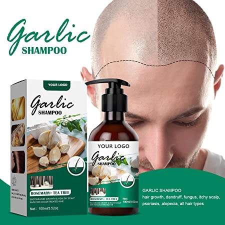 China Manufacturer Best Selling Products For Hair Loss Garlic Shampoo